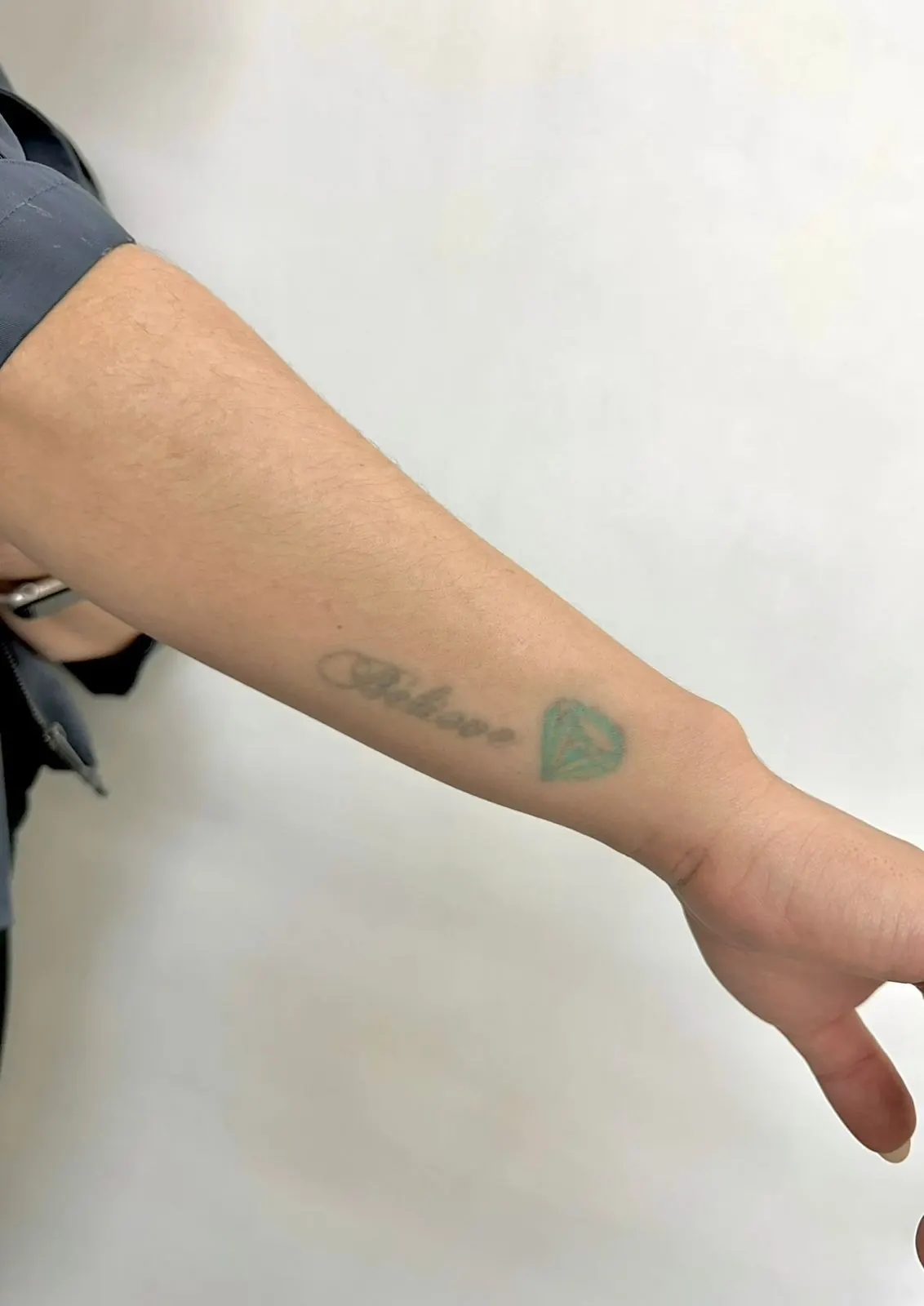 Cobertura Floral — tatuagem original antes da cobertura