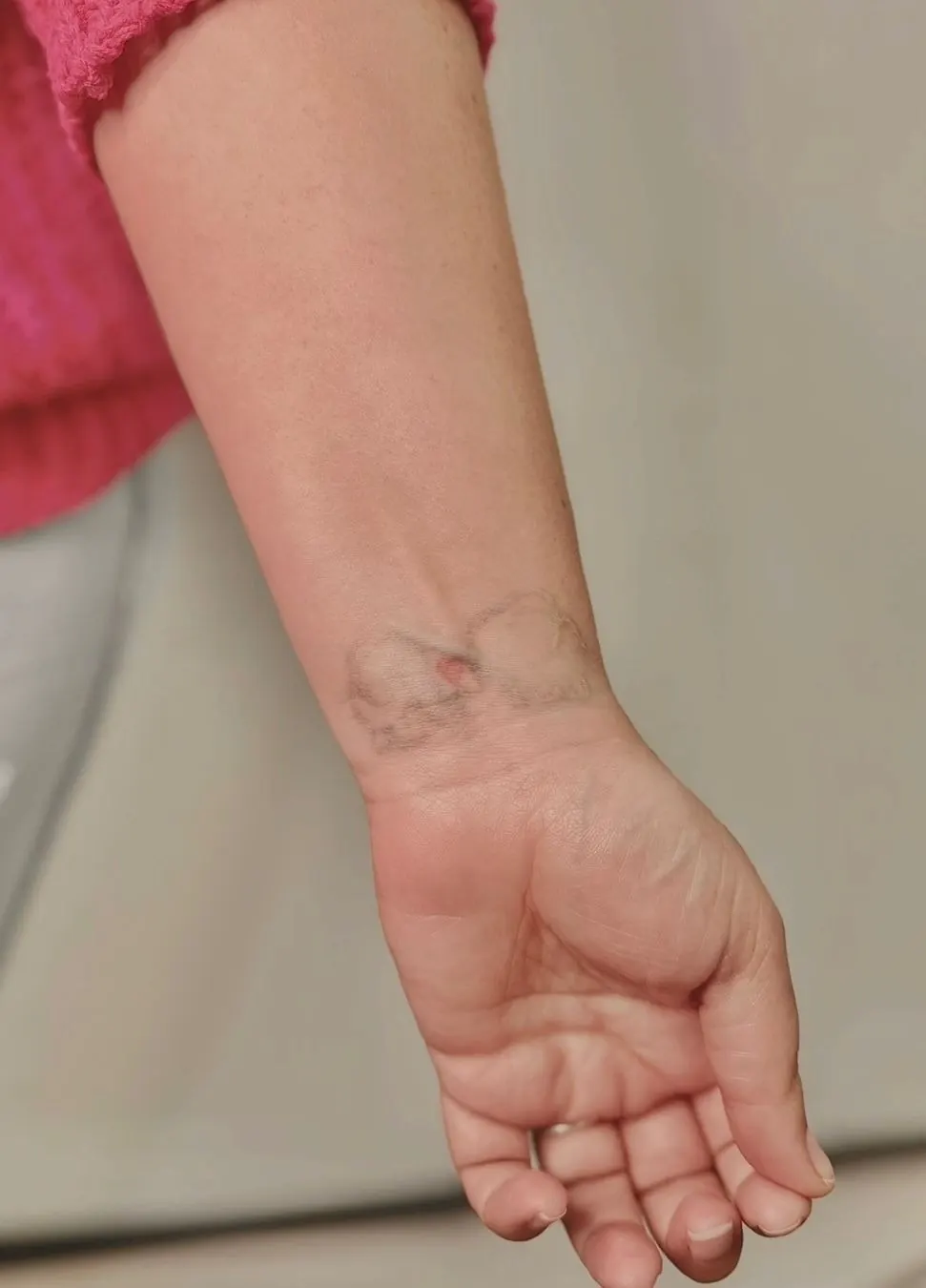 Jardim Silvestre — tatuagem original antes da cobertura